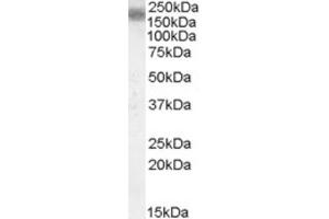Western Blotting (WB) image for anti-Low Density Lipoprotein Receptor-Related Protein 4 (LRP4) (Internal Region) antibody (ABIN2466793) (LRP4 antibody  (Internal Region))