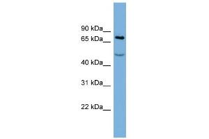 WB Suggested Anti-STIM1 Antibody Titration:  0. (STIM1 antibody  (Middle Region))