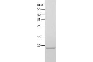 Western Blotting (WB) image for Limb-Bud and Heart (LBH) (AA 1-105) protein (His tag) (ABIN7287466) (LBH Protein (AA 1-105) (His tag))