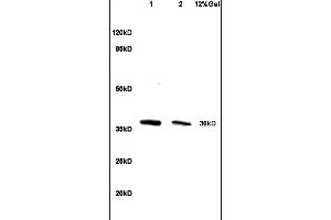 Lane 1: mouse liver lysates Lane 2: mouse intestine lysates probed with Anti HSD17B1/HSD17 Polyclonal Antibody, Unconjugated (ABIN718706) at 1:200 in 4 °C.