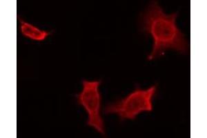 ABIN6274471 staining NIH-3T3 by IF/ICC. (MOBKL2A,B antibody)