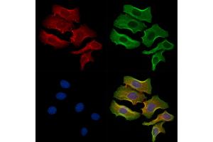 ABIN6261419 and ABIN6278340 staining Hela cells by IF/ICC.