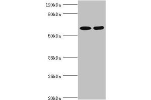 Western blot All lanes: N-acetylserotonin O-methyltransferase-like protein antibody at 2 μg/mL Lane 1: Hela whole cell lysate Lane 2: A549 whole cell lysate Secondary Goat polyclonal to rabbit IgG at 1/10000 dilution Predicted band size: 69, 68, 63 kDa Observed band size: 69 kDa