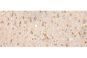 Immunohistochemistry of paraffin-embedded Human brain tissue using FKBP7 Polyclonal Antibody at dilution of 1:40(x200) (FKBP7 antibody)