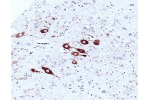 Immunohistochemical staining of a formalin-fixed paraffin-embedded rat brain tissue section with no pre-treatment (20X magnification). (NOS1 antibody  (AA 1095-1289))
