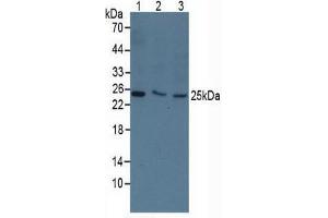 Rabbit Detection antibody from the kit in WB with Positive Control: Sample Human 293T cells. (TK1 ELISA Kit)