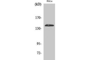 Western Blot analysis of Hela cells using PERK Polyclonal Antibody at dilution of 1:2000. (PERK antibody)