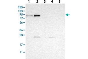 Western blot analysis of Lane 1: RT-4, Lane 2: U-251 MG, Lane 3: Human Plasma, Lane 4: Liver, Lane 5: Tonsil with SAMD4B polyclonal antibody  at 1:250-1:500 dilution. (SAMD4B antibody)