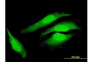 Immunofluorescence of purified MaxPab antibody to COPS8 on HeLa cell. (COPS8 antibody  (AA 1-209))