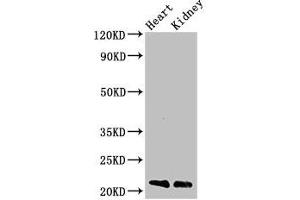Western Blot Positive WB detected in: Mouse heart tissue, Mouse kidney tissue All lanes: SDC4 antibody at 3 μg/mL Secondary Goat polyclonal to rabbit IgG at 1/50000 dilution Predicted band size: 22, 17 kDa Observed band size: 22 kDa (SDC4 antibody  (AA 19-145))
