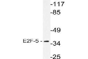 Western blot analysis of E2F5 Antibody in extracts from HeLa cells. (E2F5 antibody)
