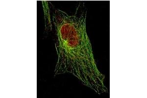 Immunofluorescence (IF) image for anti-Signal Transducer and Activator of Transcription 5A (STAT5A) (Tyr694) antibody (ABIN400812) (STAT5A antibody  (Tyr694))