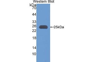 Western blot analysis of the recombinant protein. (Apolipoprotein M antibody  (AA 20-190))
