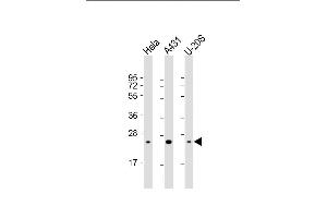 Lane 1: HeLa Cell lysates, Lane 2: A431 Cell lysates, Lane 3: U-20S Cell lysates, probed with RAB1B (1673CT667. (RAB1B antibody)