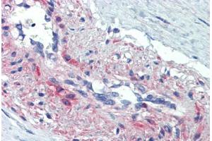 Human Vessel, Smooth Muscle (formalin-fixed, paraffin-embedded) stained with SSX4 antibody ABIN462200 followed by biotinylated goat anti-rabbit IgG secondary antibody ABIN481713, alkaline phosphatase-streptavidin and chromogen. (SSX4 antibody  (AA 108-157))