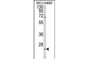 Western blot analysis of ALG14 Antibody (Center) (ABIN652850 and ABIN2842550) in NCI- cell line lysates (35 μg/lane).