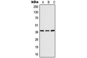 Western blot analysis of POLR3F expression in HeLa (A), mouse liver (B), rat liver (C) whole cell lysates. (POLR3F antibody  (Center))
