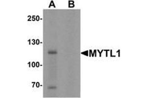 Western blot analysis of MYT1L in mouse brain tissue lysate with MYT1L Antibody  at 1 μg/mL in (A) the absence and (B) the presence of blocking peptide. (MYT1L antibody  (C-Term))