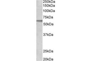 Antibody (2µg/ml) staining of MCF7 lysate (35µg protein in RIPA buffer). (ACVRL1 antibody  (C-Term))