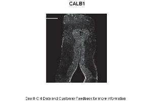 Immunohistochemistry (IHC) image for anti-Calbindin (CALB1) (C-Term) antibody (ABIN2788334)