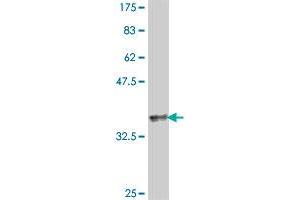 Western Blot detection against Immunogen (35. (Translin antibody  (AA 115-197))