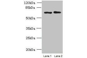 Western blot All lanes: TBC1D19 antibody at 9 μg/mL Lane 1: U251 whole cell lysate Lane 2: A375 whole cell lysate Secondary Goat polyclonal to rabbit IgG at 1/10000 dilution Predicted band size: 61, 53 kDa Observed band size: 61 kDa (TBC1D19 antibody  (AA 1-300))