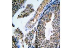 Immunohistochemical analysis of FSHR staining in human testis formalin fixed paraffin embedded tissue section. (FSHR antibody  (Center))