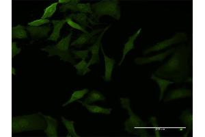 Immunofluorescence (IF) image for anti-NF-kappa-B inhibitor beta (NFKBIB) (AA 1-356) antibody (ABIN518339)