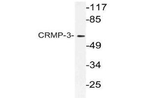 Western blot (WB) analysis of CRMP-3 antibody in extracts from HT-29 cells. (DPYSL4 antibody)