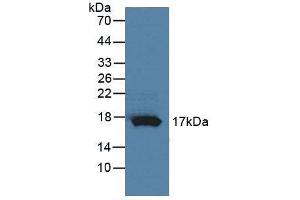 Figure. (RNASE4 antibody  (AA 30-147))