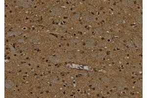ABIN6277092 at 1/100 staining Rat brain tissue by IHC-P. (PPP4C antibody  (C-Term))