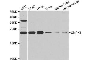 Western blot analysis of extracts of various cell lines, using CMPK1 antibody. (Cytidine Monophosphate (UMP-CMP) Kinase 1, Cytosolic (CMPK1) antibody)