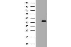 HEK293T cells were transfected with the pCMV6-ENTRY control (Left lane) or pCMV6-ENTRY HIBCH (Right lane) cDNA for 48 hrs and lysed. (HIBCH antibody)