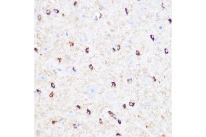 Immunohistochemistry of paraffin-embedded Mouse brain using CD47 antibody (ABIN6127604, ABIN6138199, ABIN6138201 and ABIN6223104) at dilution of 1:100 (40x lens). (CD47 antibody  (AA 20-140))