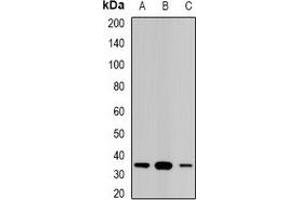 Western blot analysis of STAR expression in Jurkat (A), PC12 (B), mouse kidney (C) whole cell lysates. (STAR antibody)