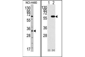 (LEFT)Western blot analysis of anti-YBX1 Antibody (N-term) in NCI-H460 cell line lysates (35ug/lane).