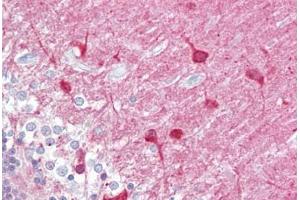 Anti-PACSIN1 antibody IHC staining of human brain, cerebellum. (PACSIN1 antibody  (AA 2-15))