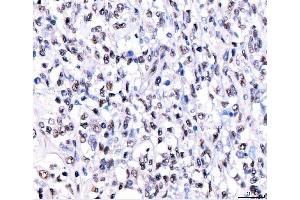 IHC analysis of CRTC3 using anti-CRTC3 antibody (ABIN7599779). (CRTC3 antibody  (AA 116-619))