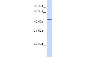MAP2K2 antibody used at 1 ug/ml to detect target protein. (MEK2 antibody  (N-Term))