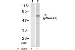 Image no. 1 for anti-Microtubule-Associated Protein tau (MAPT) (pSer422) antibody (ABIN319249) (MAPT antibody  (pSer422))