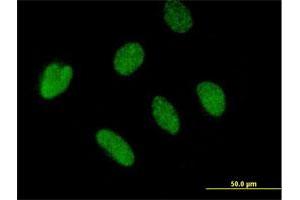 Immunofluorescence of purified MaxPab antibody to BTBD4 on HeLa cell. (ZBTB46 antibody  (AA 1-589))