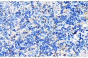 Immunohistochemistry of paraffin-embedded Mouse spleen using FLNA Polyclonal Antibody at dilution of 1:100 (40x lens). (Filamin A antibody)