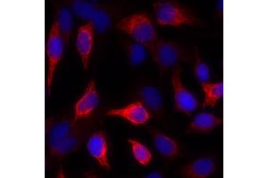 Immunofluorescence (IF) image for anti-Keratin 1 (KRT1) antibody (ABIN7449048) (Cytokeratin 1 antibody)