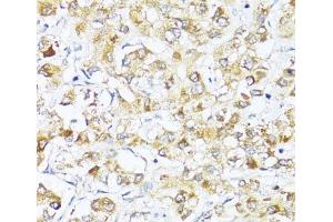 Immunohistochemistry (Paraffin-embedded Sections) (IHC (p)) image for anti-Eukaryotic Translation Initiation Factor 2 Subunit 1 (EIF2S1) antibody (ABIN7254993)