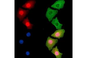 ABIN7095267 and ABIN7099324 staining Hela cells by IF/ICC. (LTC4S antibody)