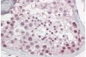 Image no. 2 for anti-Pescadillo Ribosomal Biogenesis Factor 1 (PES1) (N-Term) antibody (ABIN374331)
