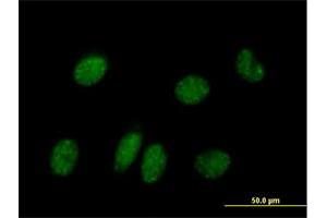 Immunofluorescence of purified MaxPab antibody to NPAS2 on HeLa cell. (NPAS2 antibody  (AA 1-824))