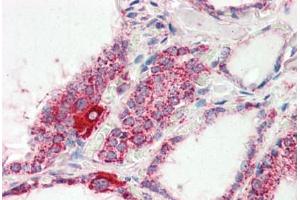 Human Thyroid (formalin-fixed, paraffin-embedded) stained with COX4I1 antibody ABIN461950 at 2. (COX IV antibody  (AA 154-166))