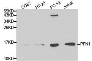 Western Blotting (WB) image for anti-Profilin 1 (PFN1) antibody (ABIN1874102) (PFN1 antibody)