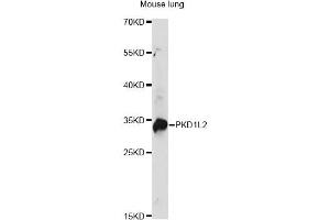 Western blot analysis of extracts of mouse lung, using PKD1L2 antibody. (PKD1L2 antibody)
